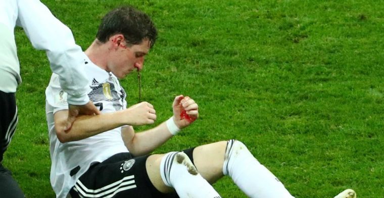 Nare blessures op WK: Toivonen bezorgt Duitser gebroken neus, Farfán in ziekenhuis